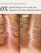Alpha-H Healthy Scalp exfoliační roztok na hlavu 100 ml