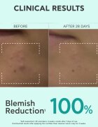 Apivita Just Bee Clear Purifying Cleanser Gel čisticí pleťový gel proti akné 200 ml