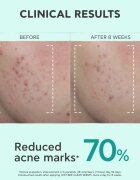 Apivita Just Bee Clear Serum sérum pro mastnou a problematickou pleť 30 ml