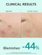 Apivita Just Bee Clear Serum sérum pro mastnou a problematickou pleť 30 ml