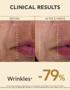Apivita Queen Bee Longevity lehký krém pro zpevnění pleti 50 ml