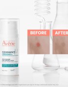 Avène Cleanance Comedomed+ intenzivní péče proti nedokonalostem aknózní pleti 30 ml