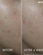 Biotherm Aquasource+ Vitamin Glow Gel pleťový gel 30 ml