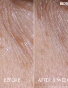 Biotherm Blue Peptides Eyes Lips Contour Reshaper péče na oční okolí a rty 15 ml