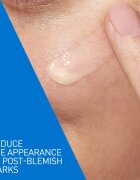 CeraVe Control Cleanser & Retinol Serum Duo komplexní péče proti nedokonalostem aknózní pleti