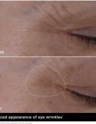 Clarins Double Serum Eye protivráskové sérum na oční okolí s vyživujícím účinkem 20 ml
