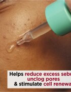 Clarins My Pure-Reset Resurfacing Blemish Serum obnovující sérum pro mastnou pleť se sklonem k akné 30 ml