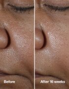 Clinique Smart Clinical™ Repair Wrinke Correcting Serum pleťové sérum pro korekci vrásek 100 ml