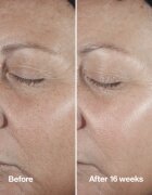 Clinique Smart Clinical™ Repair Wrinke Correcting Serum pleťové sérum pro korekci vrásek 75 ml