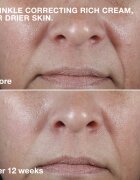 Clinique Smart Clinical™ Repair Wrinkle Correcting Cream vyživující protivráskový krém 75 ml