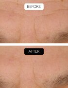 Cocunat Clinical Beauty Filler set proti stárnutí pleti