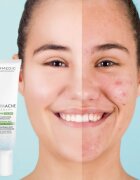 Dermedic Normacne Therapy hydratační krém na aknózní pleť 40 ml