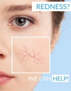 Dermedic Redness Calm micelární voda pro citlivou pleť se sklonem ke zčervenání 500 ml