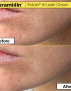 Dr. Jart+ Ceramidin™ Ectoin-Infused Cream hydratační krém na obličej s ceramidy 50 ml