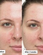 Dr. Jart+ Cicapair™ So Soothing Treatment lokální péče neutralizující zarudnutí 30 ml