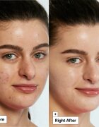 Dr. Jart+ Cicapair™ Tiger Grass Color Correcting Treatment intenzivní krém redukující začervenání pleti 50 ml