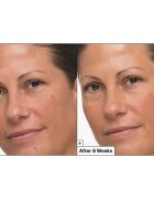 Dr. Jart+ Prejuvenation Cream with Bakuchiol regenerační a zpevňující krém proti příznakům stárnutí 50 ml