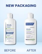 Ducray Kelual Squanorm Regulating Treatment Shampoo Oily Dandruff šampon proti mastným lupům 400 ml