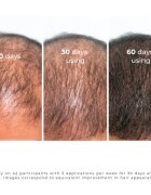 Elfa Pharm Intensive Cosmetic Intensive Hair Therapy Natural Burdock Oil For Hair Treatment olej proti padání vlasů s růstovým aktivátorem 100 ml