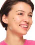 essence Spot Squad Pimple Patches náplasti na problematickou pleť 32 ks