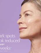 Estée Lauder Perfectionist Pro Rapid Brightening Treatment with Ferment³ + Vitamin C rozjasňující sérum s vitaminem C proti tmavým skvrnám 50 ml