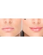 FacEvolution LipPlus Booster péče pro zvětšení objemu rtů odstín Transparent 5 ml