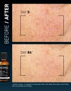 FILORGA DAILY PEEL ANTI-DARK SPOT pleťový peeling proti tmavým skvrnám 50 ml