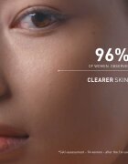 FILORGA SKIN PREP AHA CLEANSING GEL čisticí peelingový gel 150 ml
