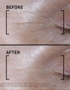 FILORGA TIME-FILLER SHOT intenzivní sérum proti prvním známkám stárnutí pleti 15 ml