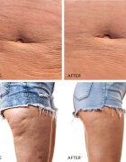FOREO BEAR™ 2 body mikroproudový tonizační přístroj na tělo Lavender 1 ks