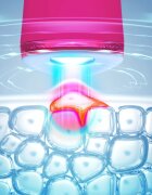 FOREO ESPADA™ 2 pero s modrým světlem pro zmírnění projevů akné Fuchsia 1 ks
