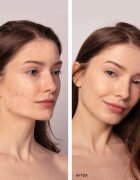 FOREO ESPADA™ 2 Plus pero s modrým světlem pro zmírnění projevů akné Lavender 1 ks