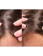 FOREO FAQ™ Scalp Recovery & Thick Hair Probiotic Serum probiotické sérum pro regeneraci vlasů a vlasové pokožky 60 ml