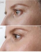FOREO IRIS™ Firming Eye Serum omlazující oční sérum 15 ml