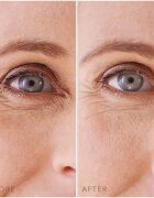 FOREO IRIS™ Hydrogel Eye Mask hloubkově hydratační maska na oční okolí 60x1 ks
