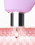FOREO KIWI™ Derma zařízení pro diamantovou mikrodermabrazi a čištění pórů 1 ks