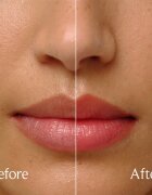 fresh Sugar Treat Lip Oil olej na rty limitovaná edice odstín Rose 4 ml
