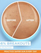 Garnier Ambre Solaire Super UV Niacinamide lehký ochranný fluid proti nedokonalostem pleti SPF 50+ 40 ml