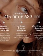 GLOV Supernova Acne Spot Treatment Patch ošetřující LED maska 1 ks