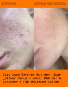 Glow Hub The Scar Slayer rozjasňující sérum proti pigmentovým skvrnám 30 ml