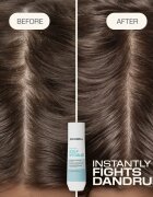 Goldwell Dualsenses Scalp Specialist Anti-Dandruff Shampoo šampon proti lupům 250 ml