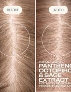 Goldwell Dualsenses Scalp Specialist Anti-Dandruff Shampoo šampon proti lupům 250 ml