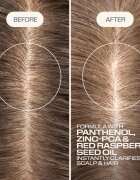 Goldwell Dualsenses Scalp Specialist Clarifying Shampoo hloubkově čisticí šampon 1000 ml