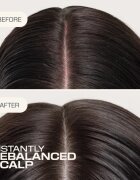 Goldwell Dualsenses Scalp Specialist Rebalance & Hydrate Fluid hydratační fluid pro obnovu pokožky hlavy 150 ml