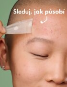 Hero Cosmetics Mighty Patch XL náplasti na problematickou pleť 10 ks