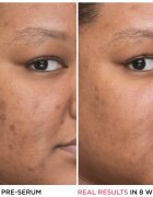 IT Cosmetics Bye Bye Dark Spots zesvětlující korekční sérum proti pigmentovým skvrnám s niacinamidem pro ženy 30 ml