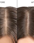 KERASILK Specialists Exfoliating Scalp & Hair Treatment předšamponová péče s exfoliačním účinkem 200 ml