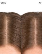 KERASILK Specialists Moisturizing Scalp Drops kapky pro suchou a citlivou pokožku hlavy 100 ml