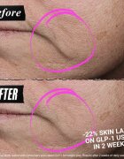 Kiehl's CollaShot Plump Serum kolagenové sérum pro vyplnění a obnovu pleti pro ženy 30 ml