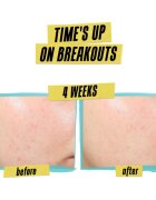 Kiehl's Dermatologist Solutions Expertly Clear Blemish-Treating & Preventing Lotion krém na obličej na aknózní pleť pro ženy 60 ml